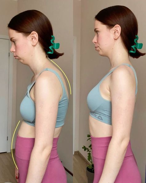 Straighter everyday posture