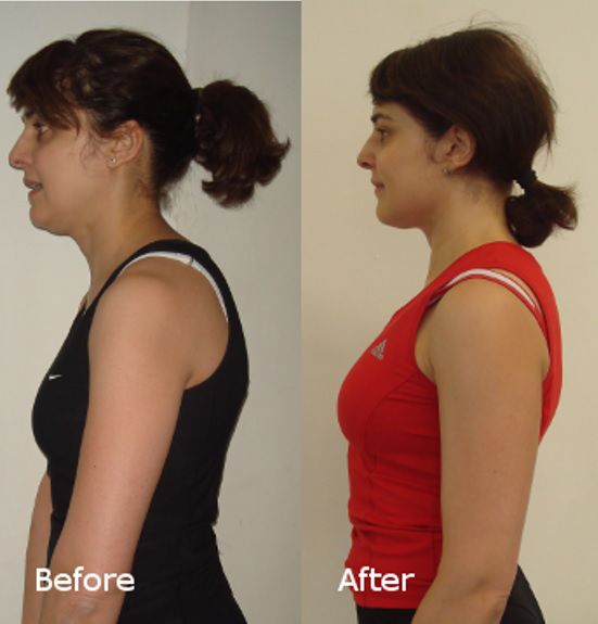 Straighter everyday posture